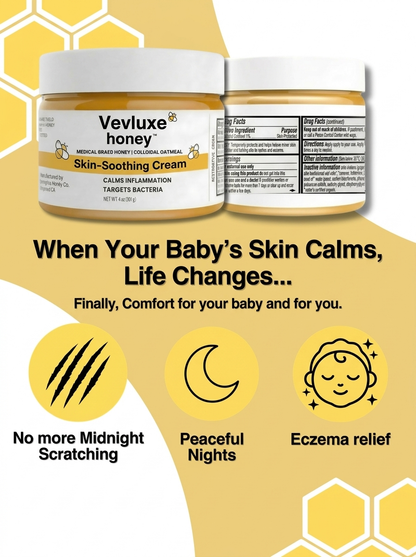 Vevlux's™ Honey Eczema Cream